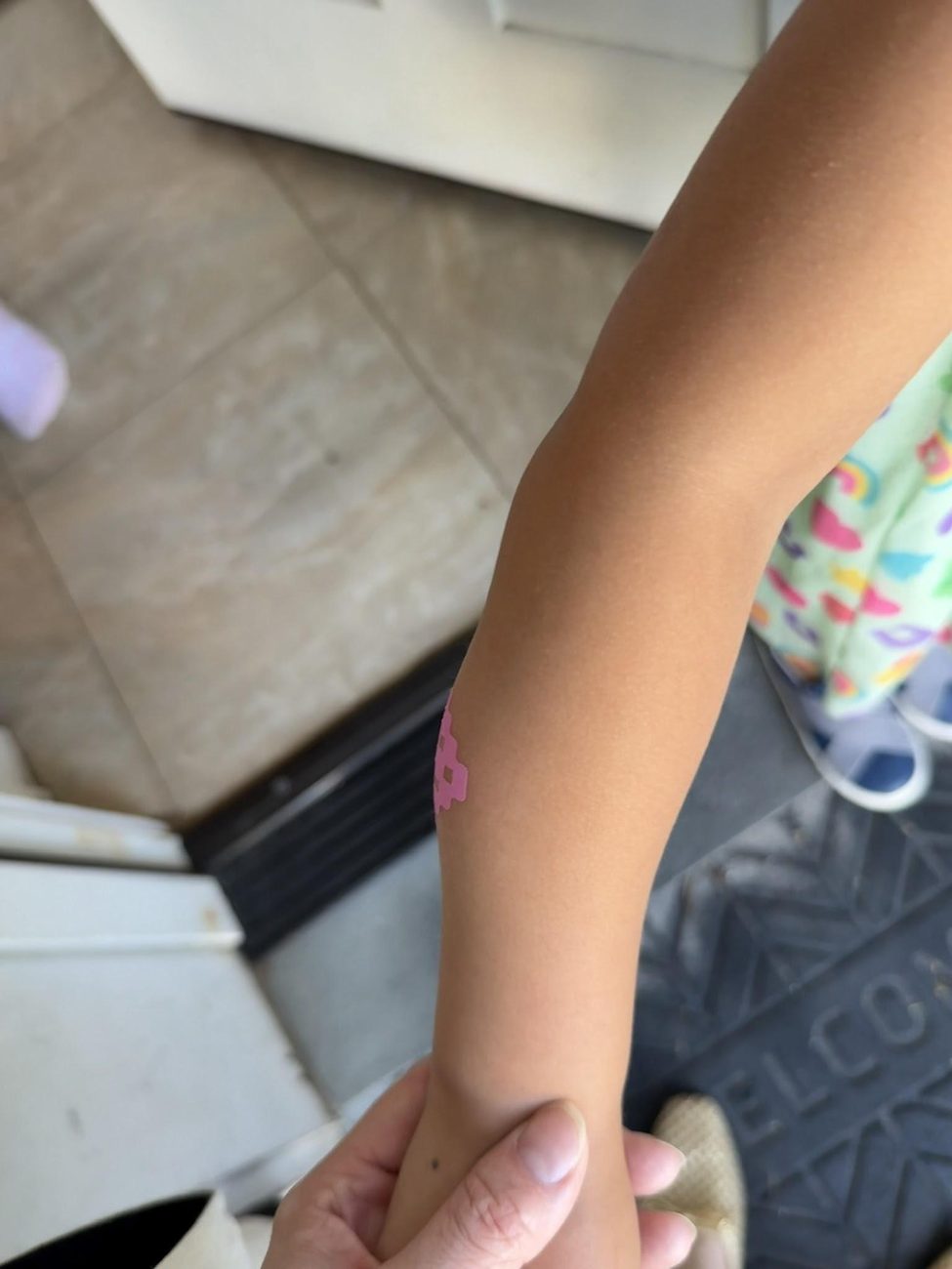 A young child's arm being held by an adult, with a treated bite site